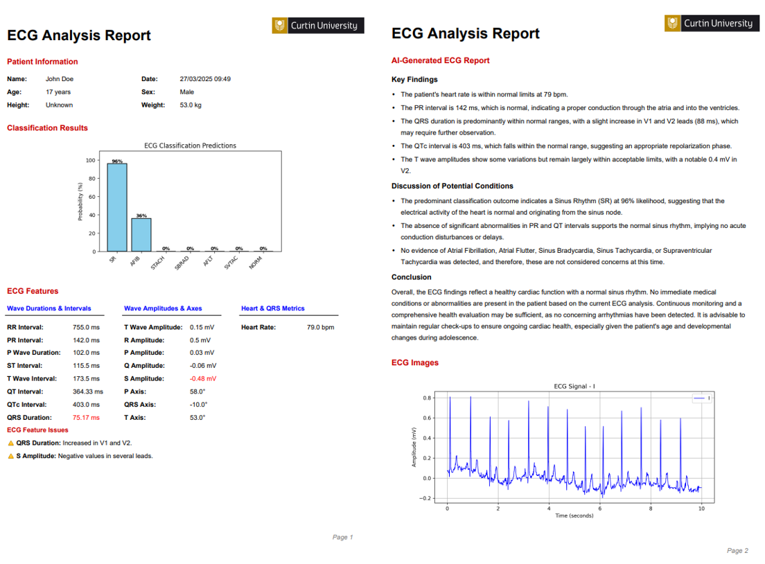 ECG report example output